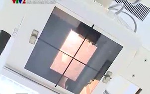 Hãy chia sẻ cùng chúng tôi : Điều trị thoái hóa khớp